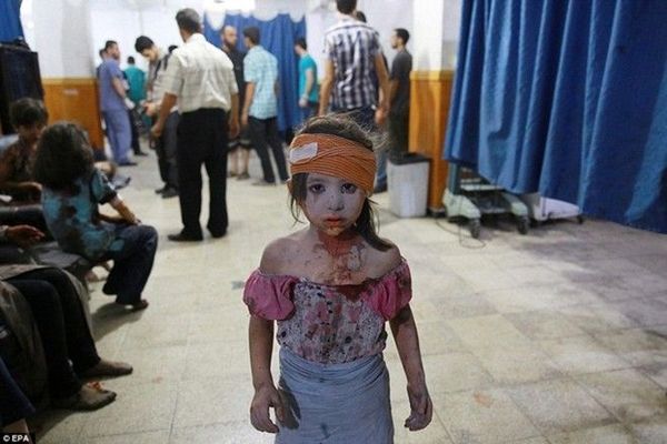 Một bé gái người Syria bị thương đang nhìn thẳng vào ống kính tại bệnh viện nằm ở khu vực phiến quân nắm giữ ở Douma, phía Tây thủ đô Damascus sau cuộc đột kích của chính phủ Syria vào ngày 22/8/2015. Bức ảnh được nhiếp ảnh gia Abd Doumany ghi nhận giành được giải Nhì hạng mục Tin tức tổng hợp.